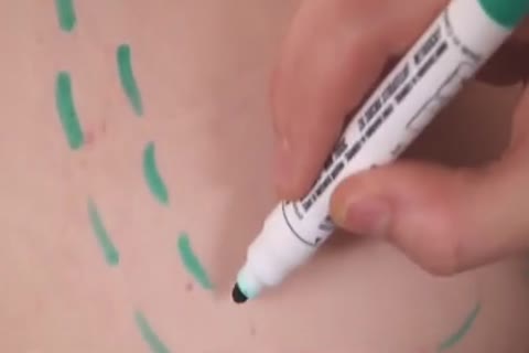 raw Medics 1 - Parte 04